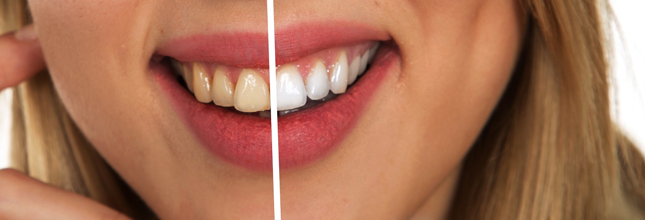 does vape stain teeth How to Vape Properly: Beginner's Guide [2026] main image 0