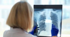 صورة اشغة للرئتين