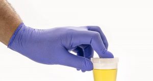 تحليل البول