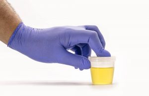 Vaping, Metabolic Health, and the Bigger Picture: Separating Facts from Fear تحليل البول