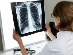 The Growing Body of Literature on The Effect of Vaping on Cardiopulmonary Health رئة الفشار و السجائر الالكترونية